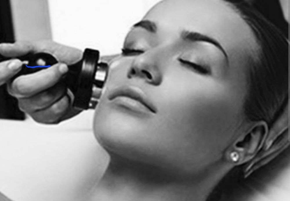 Radiofrequency Facial