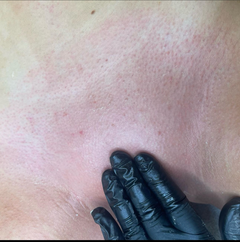 Brazilian Wax