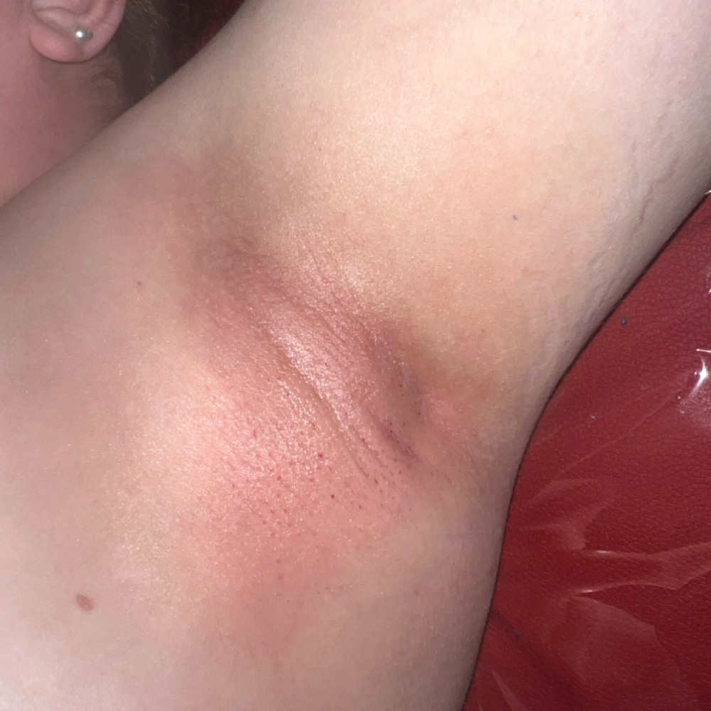 Underarm Wax at Skylar Ashley Aesthetics in Leitchfield, KY