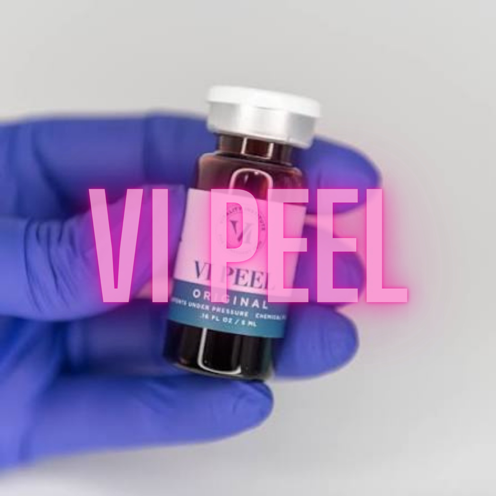 VI Peel Original at The Aesthetics Boutique in Ellisville, MO