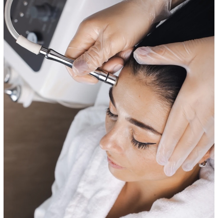 Microdermabrasion Facial