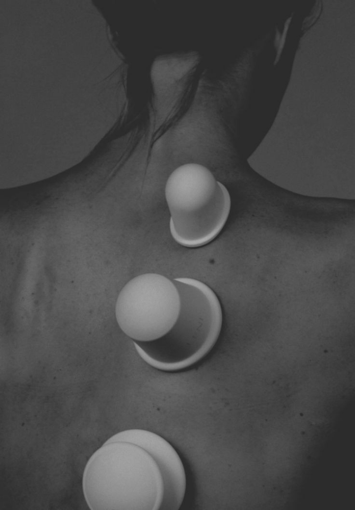 Cupping Therapy