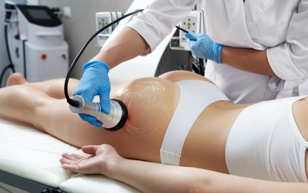 Fat Cavitation