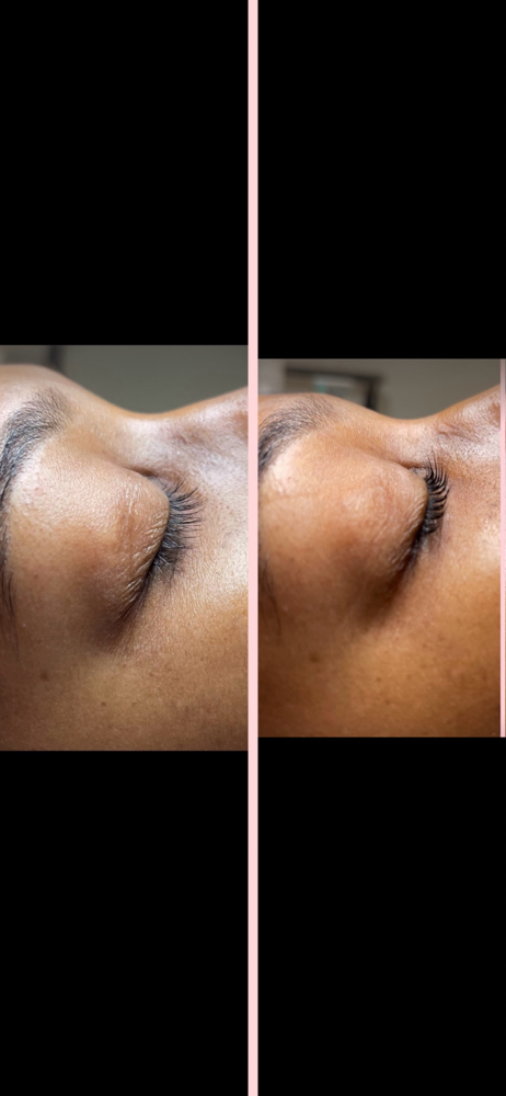 Eyelash Lift