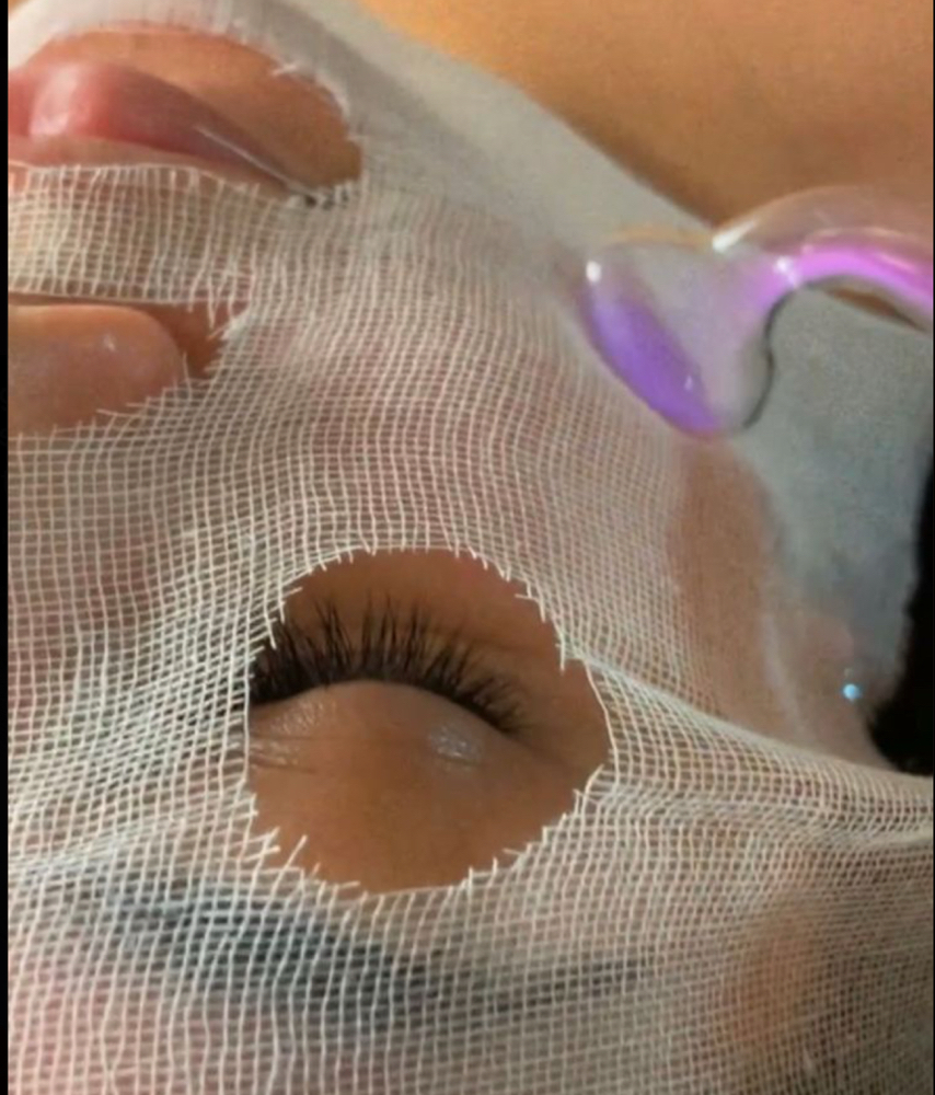 High-Frequency Acne Treatment at Luna Vita Esthetics in Lowell, AR