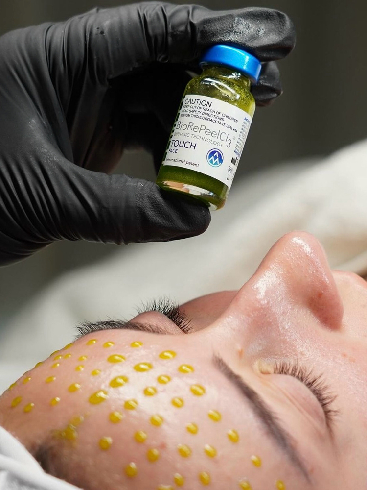 Biorepeel Facial