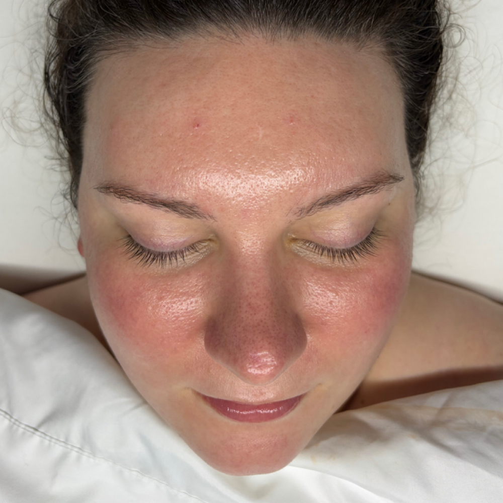 Celestial Facial at Ethereal Esthetics in Huntsville, AL