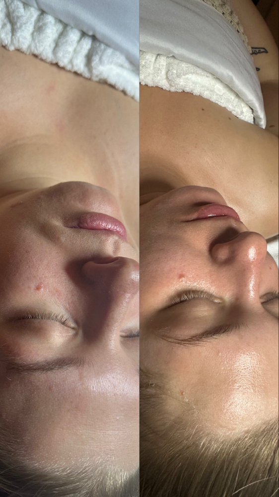 Custom Facial