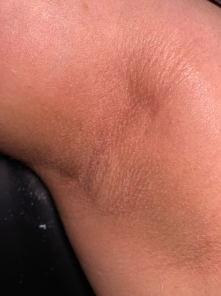 Underarm Wax