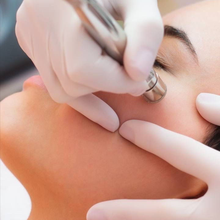 Diamond Microderm Full Facial at Radiant Reflections Spa in Moorhead, MN