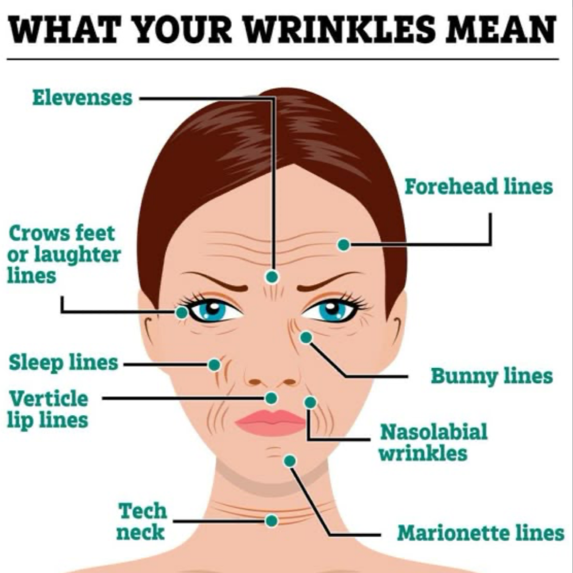 2-10 Units of Xeomin