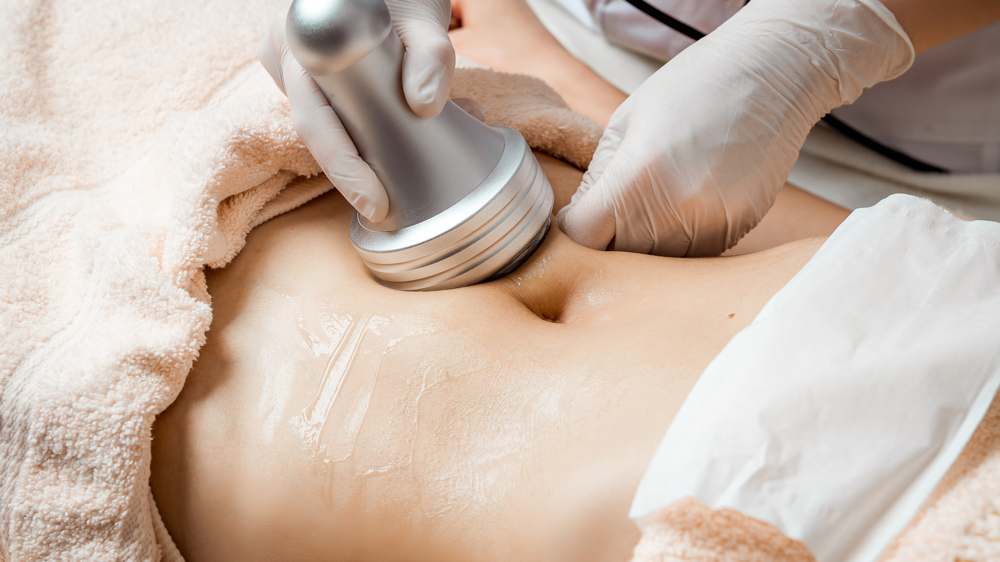 Non Invasive Fat Reduction Add On