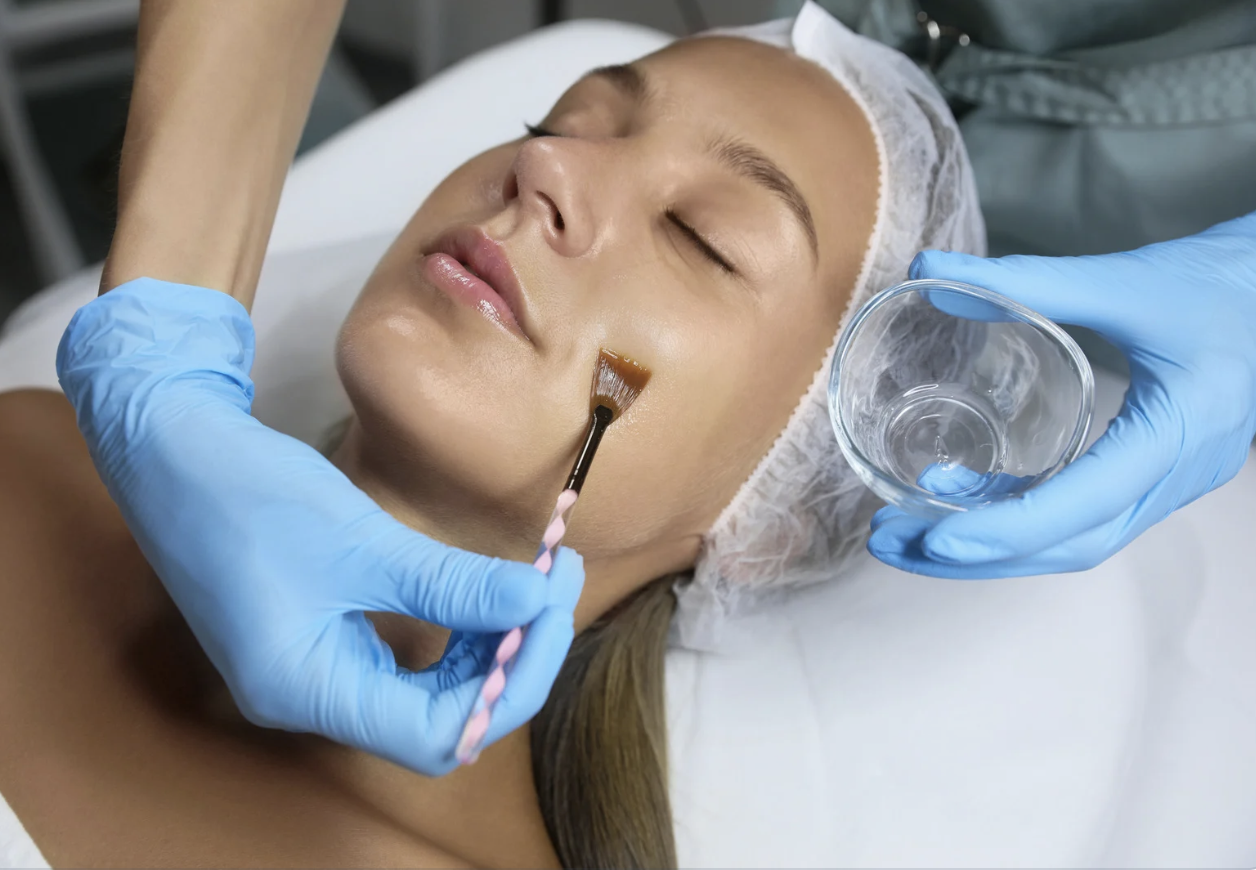 Dermafrost Peel