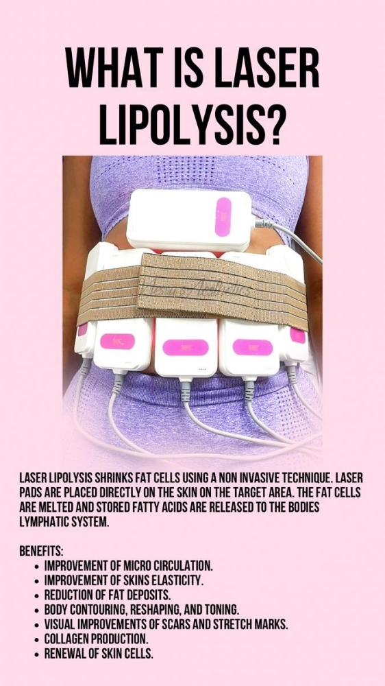 Laser Lipolysis
