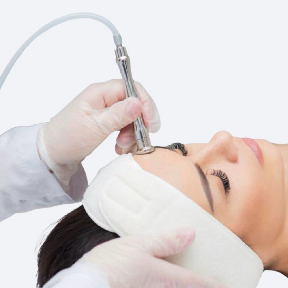 Microdermabrasion at Sol & Skin Wellness in Duncanville, TX
