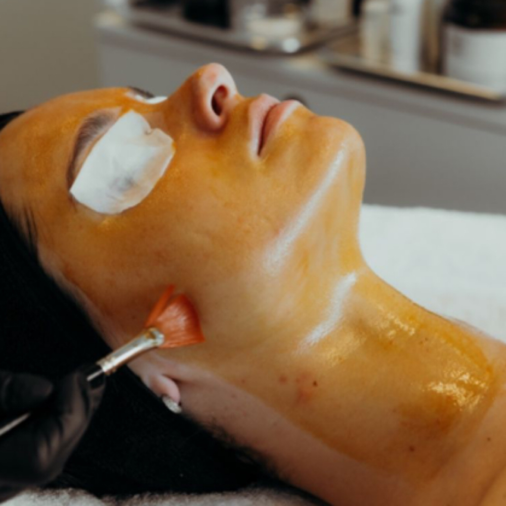 Chemical peel at Olive.glowesthetics in West Monroe, LA