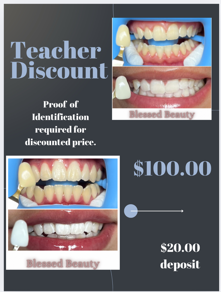 Teeth Whitening/Teacher Discount at Blessed Beauty in El Paso, TX