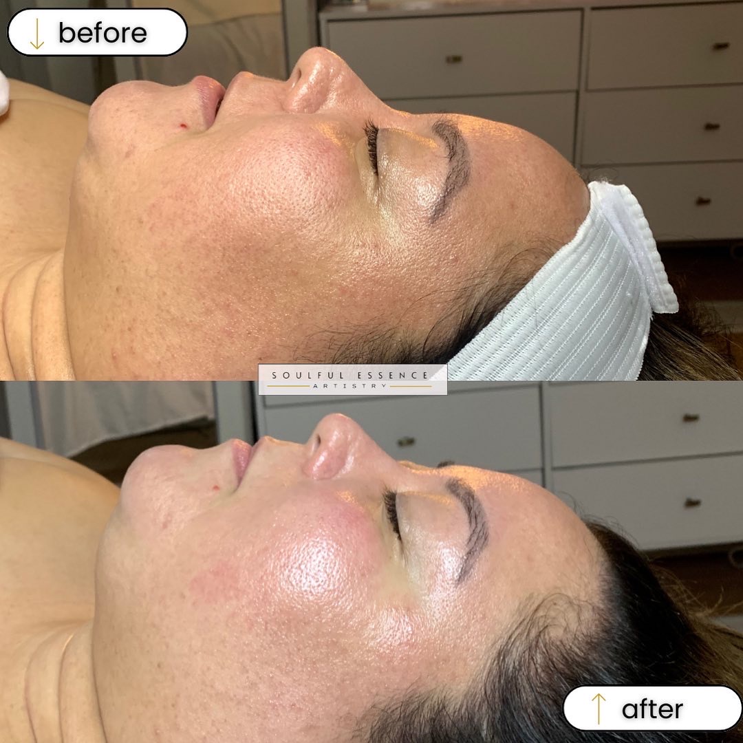 The Soulful Customized Facial