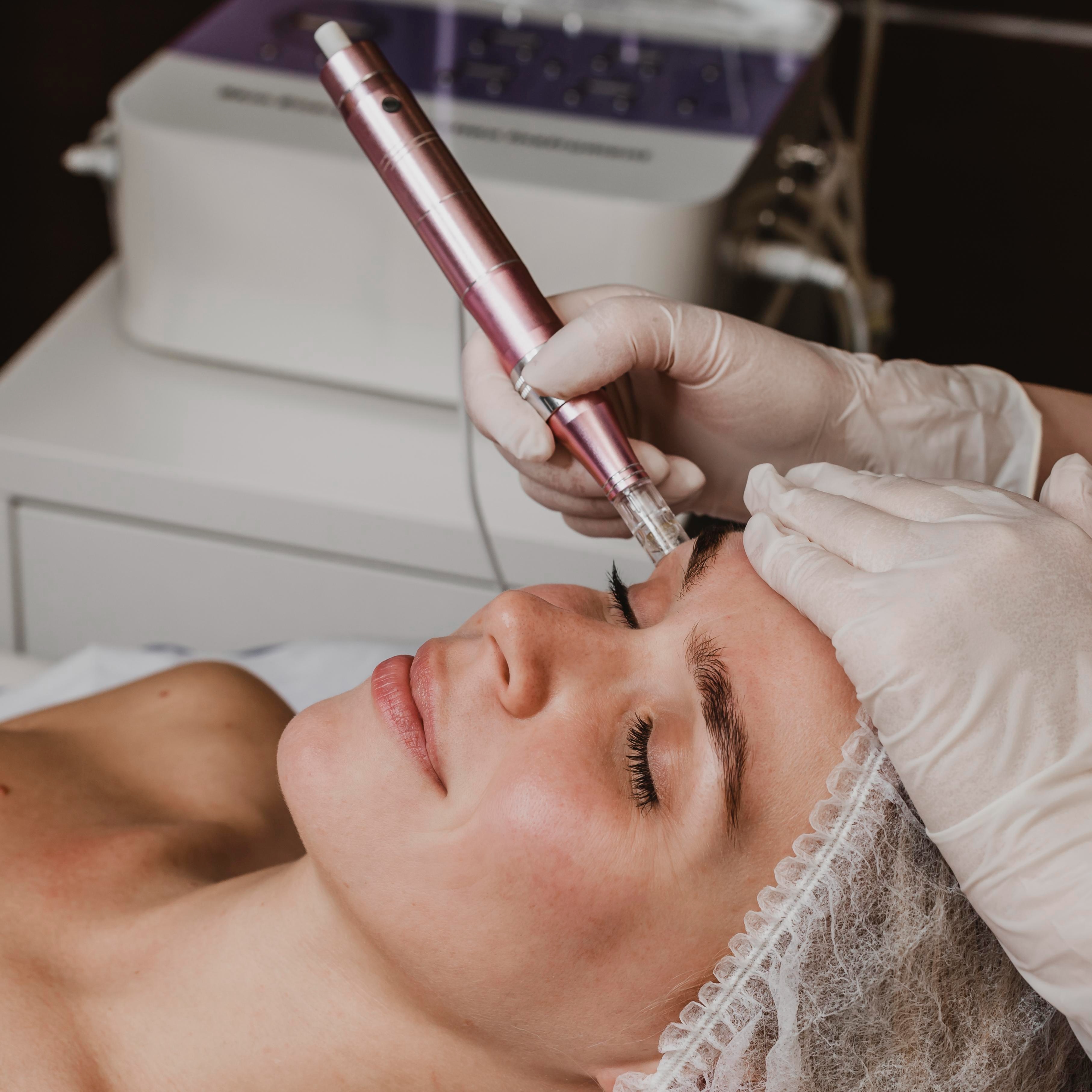 Micro needling/Collagen Induction at Celtic Spa Laser Services in Attleboro, MA