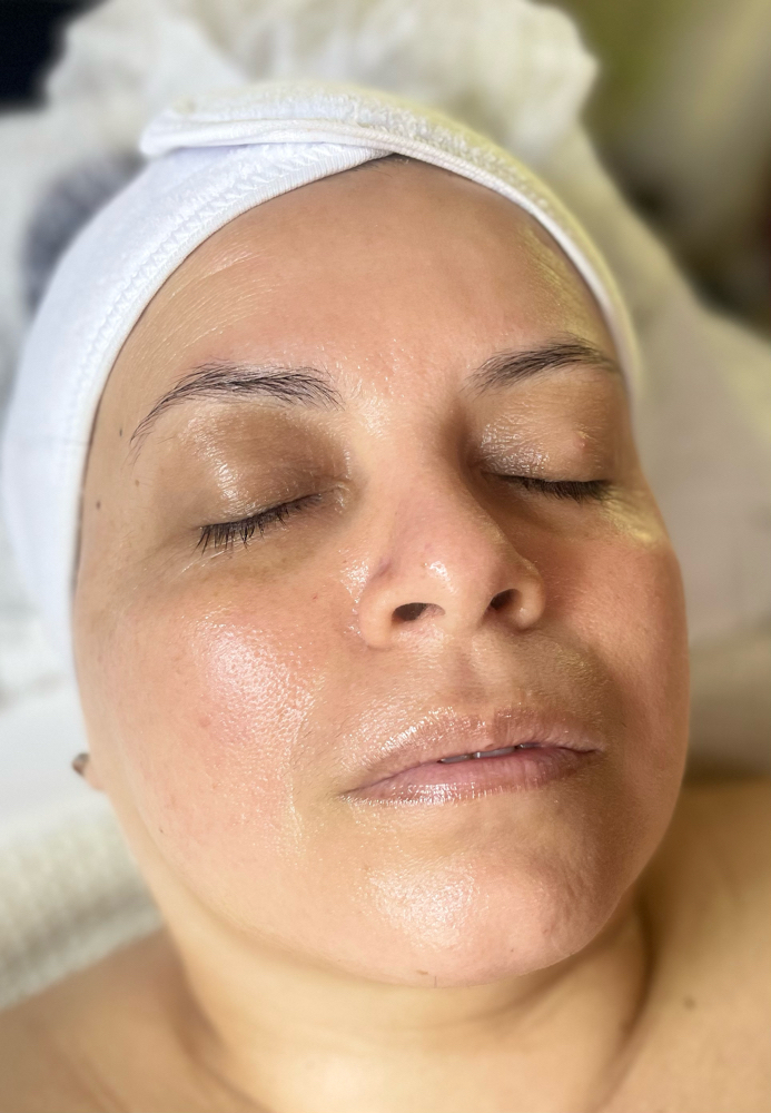 Lifting Facial