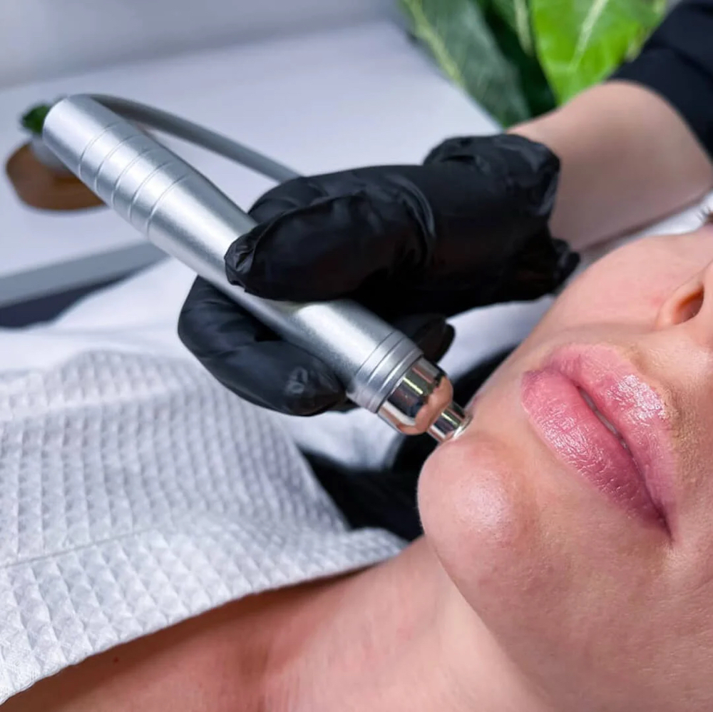 HydroDiamond Luxe Facial at REVIVED SKIN ESTHETICS in CYPRESS, CA
