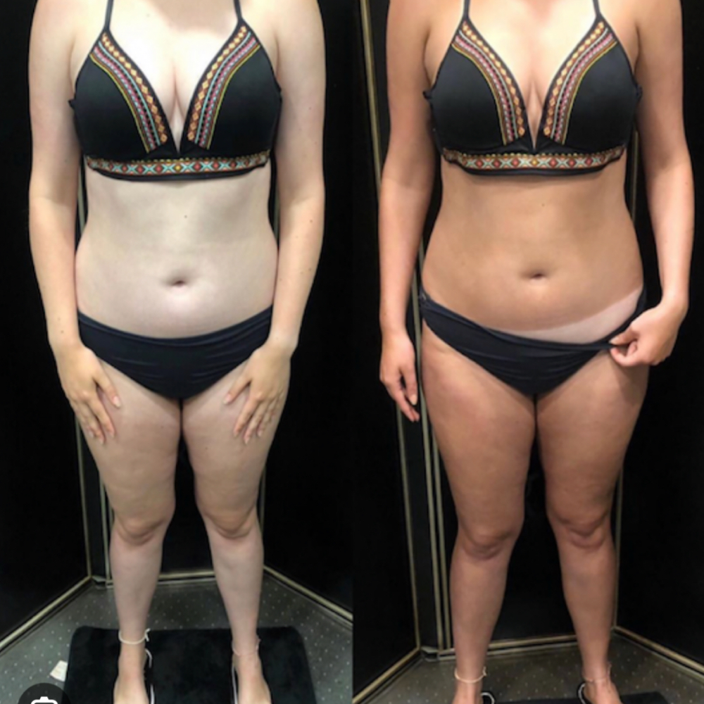 NUDA Spray Tan at Get up and Glow in Blaine, MN