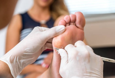 Routine Foot Care Procedures