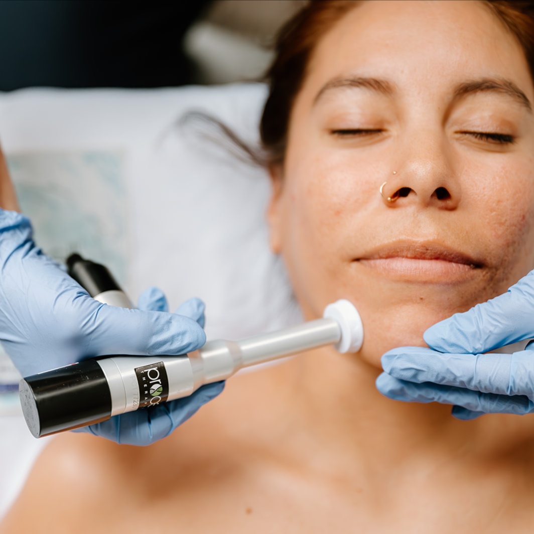 ProCell Micro-channeling Treatment at Face Food Natural Skincare in Newburyport, MA
