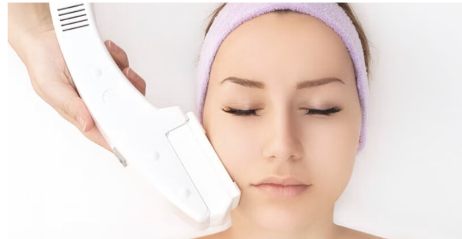 Photo Facial