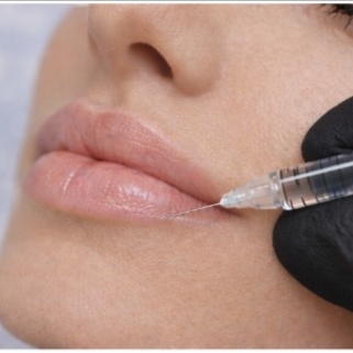 Lip Filler at Brivanna Medical & Wellness, P.C. in Katy, TX