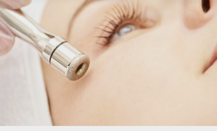 Add On Microdermabrasion