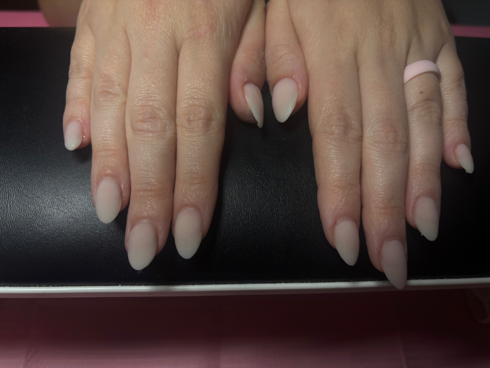 Acrylic Overlay