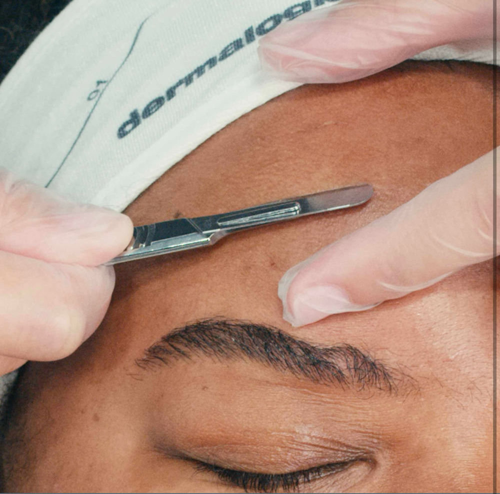 Dermaplaning