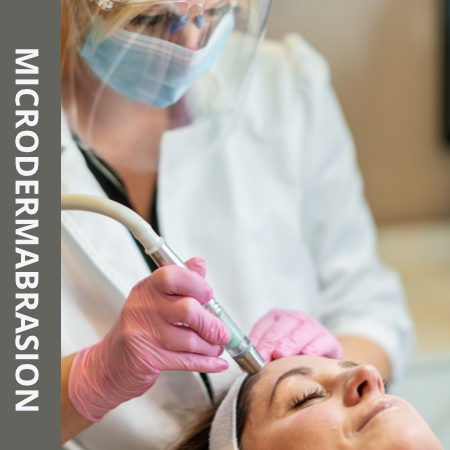 Microdermabrasion Treatment