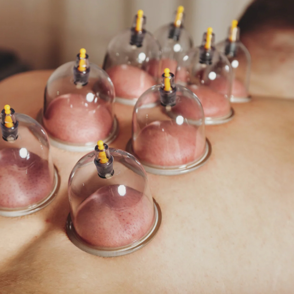 Cupping Add-On at Jazmine’s Bodywork’s in Kennett, MO