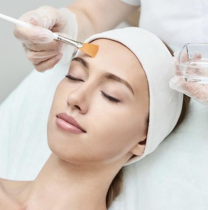 Acne Peel