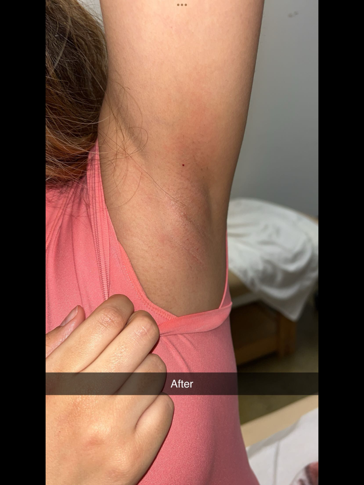 Underarm Wax