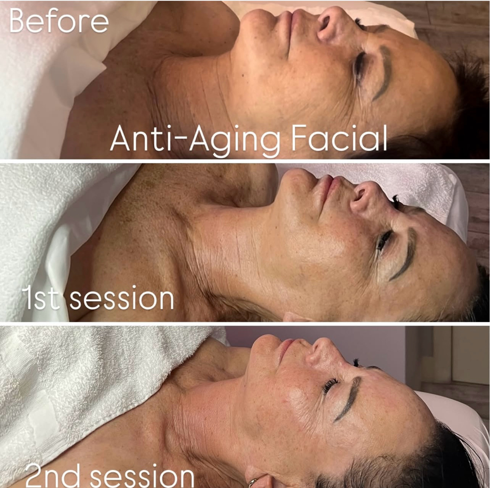 Anti-Aging Facial