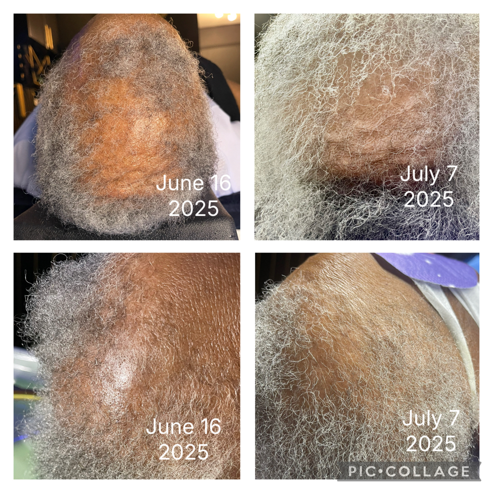 New Client Hair Growth Consultation