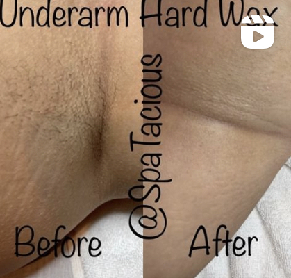 Underarm Wax