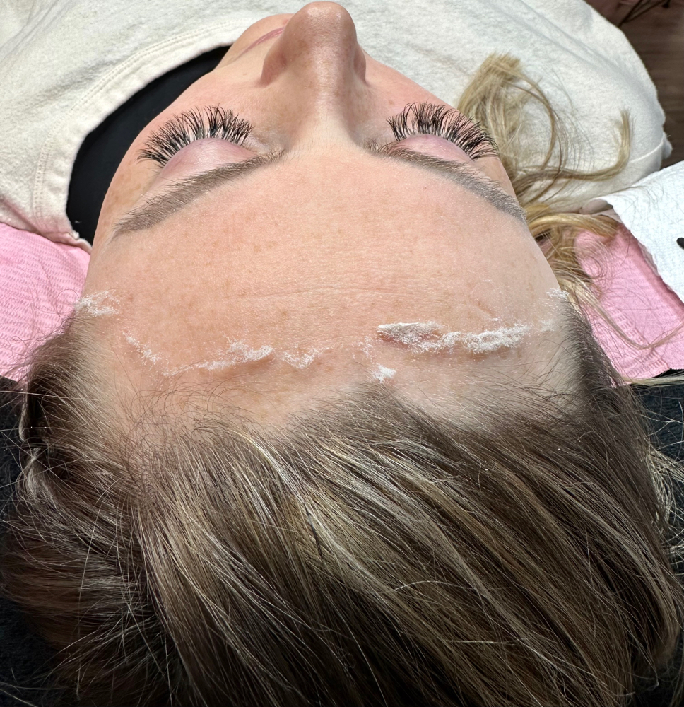 Dermaplane Only