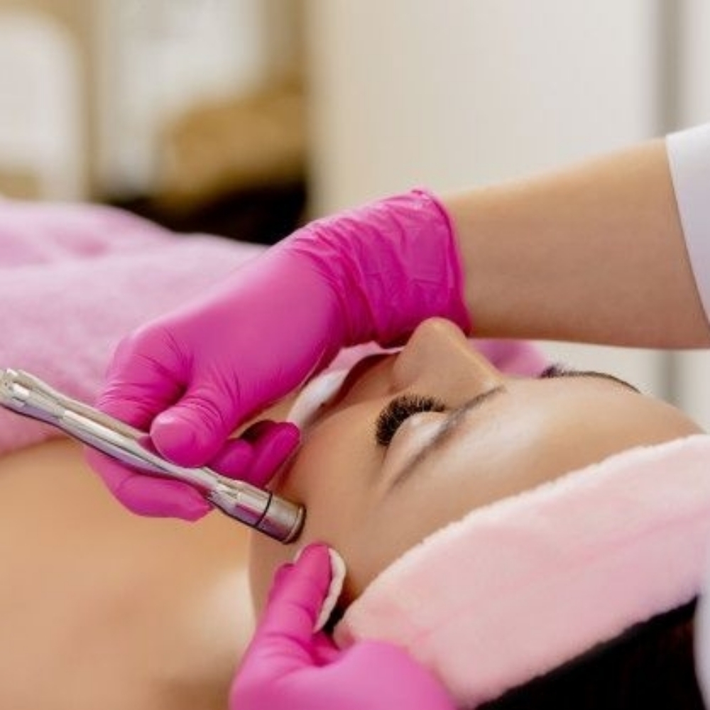 Diamond Microdermabrasion (Add-On) at Crystalyn Couture 👑 Salon & Spa in Surprise, AZ