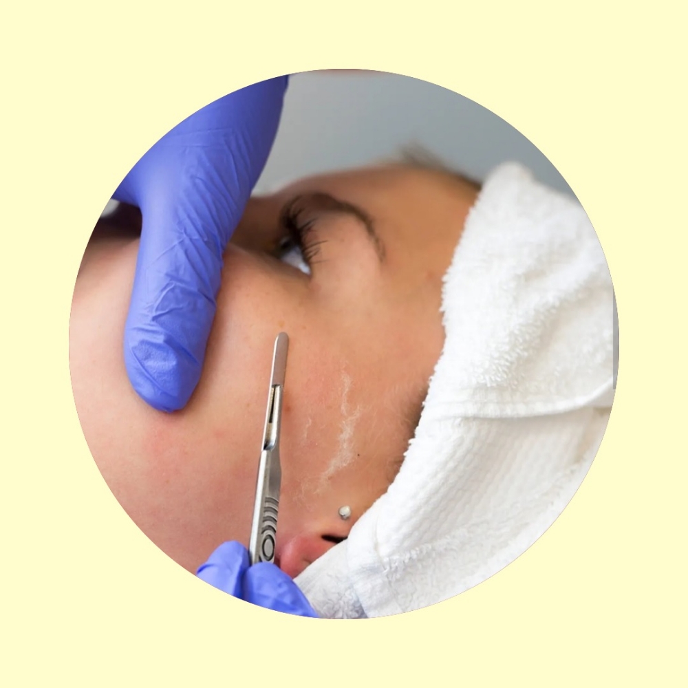 ~ Add On: Dermaplaning