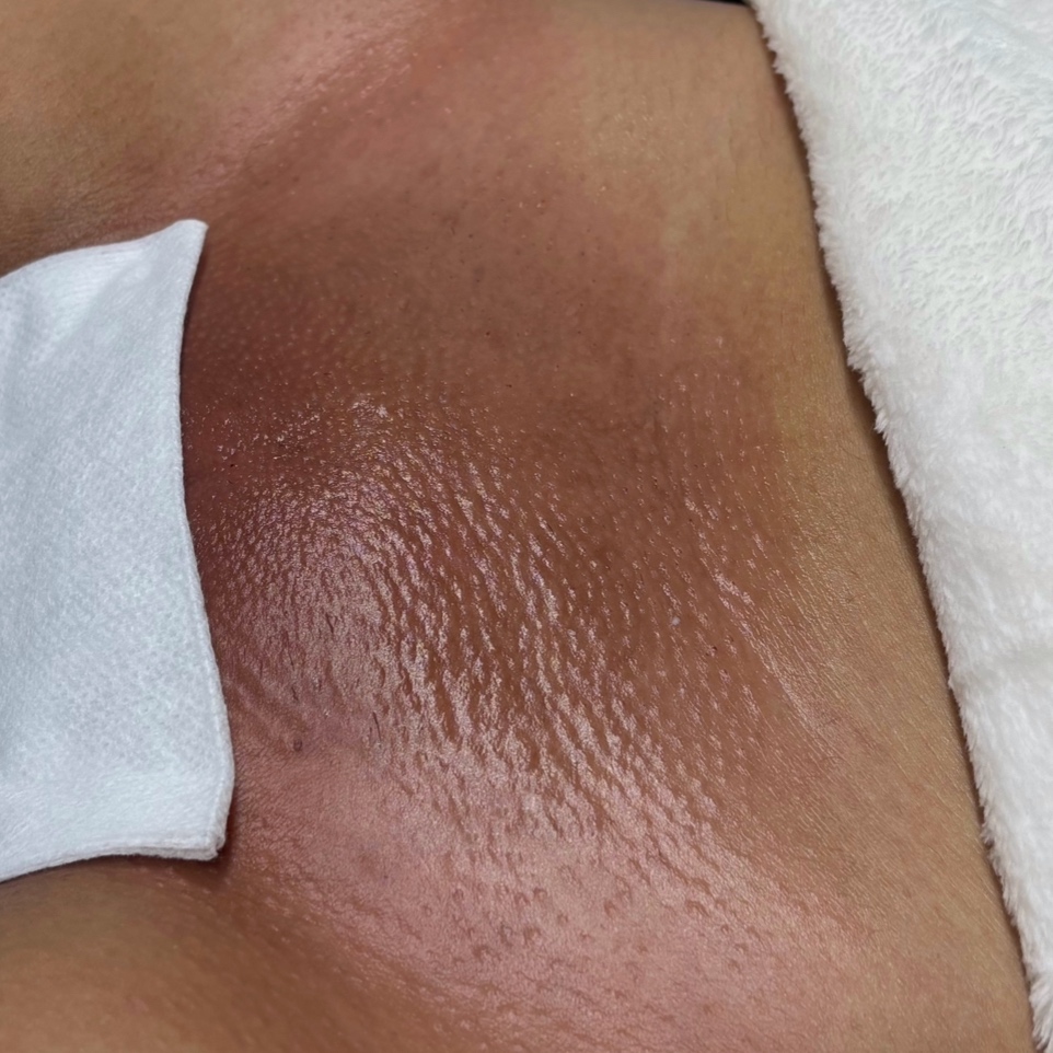 Brazilian Wax at Jennssesthetics in College Park, MD