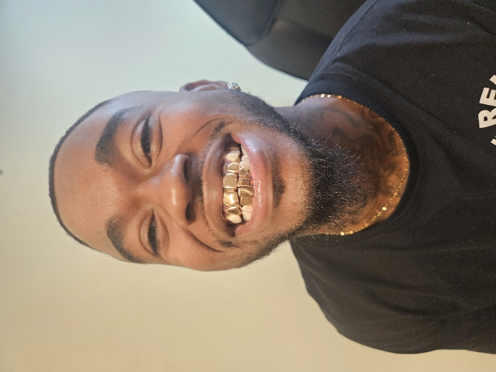 24k Gold Grill Per Tooth