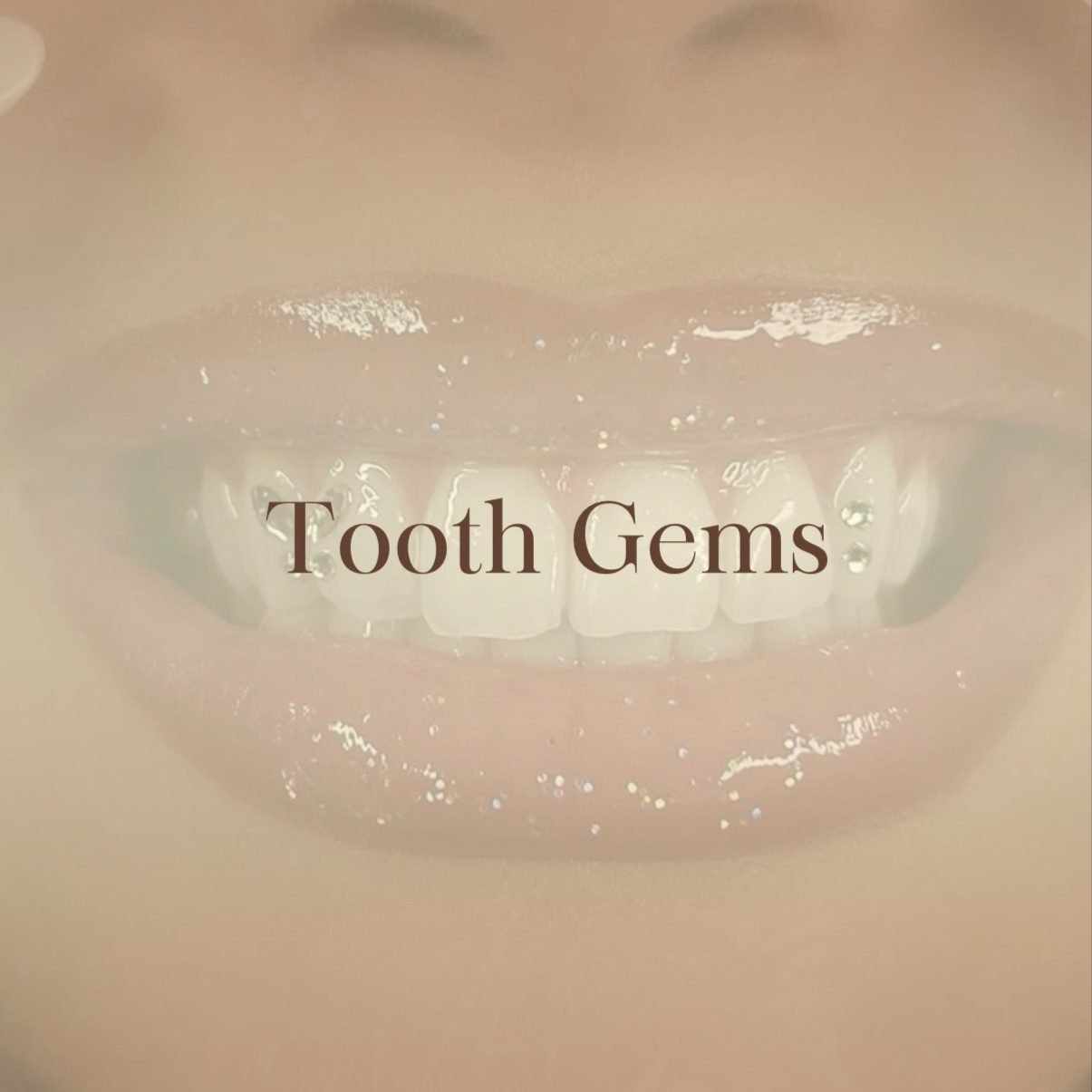 Tooth Gems at Kat-Le Studio in Thousand Oaks, CA