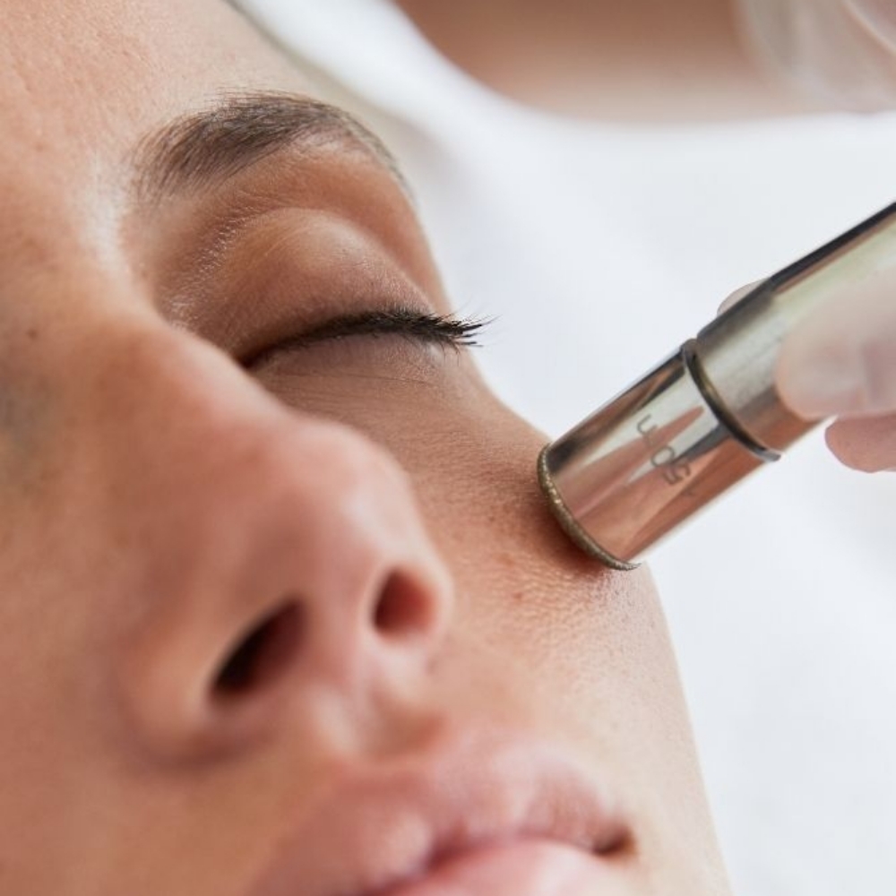 Microdermabrasion at Haus of Glam by Karina J in Haverhill, FL