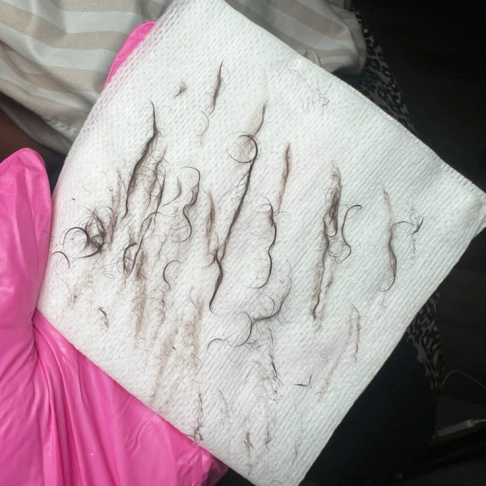Dermaplane Express at Skin by Payton Esthetics in Goldsboro, NC