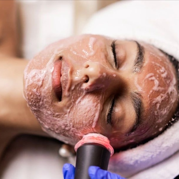 OxyGlow Facial at RSB Med Spa in Kansas City, MO