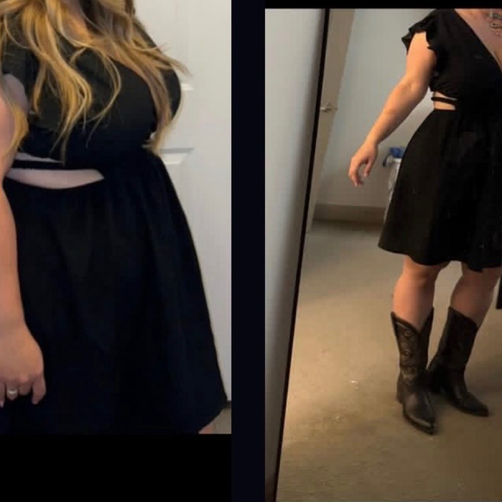 Weight Loss Consultation at 360 Beauty in San Antonio, TX
